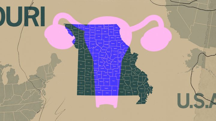 What It’s Like to Get an Abortion in Missouri